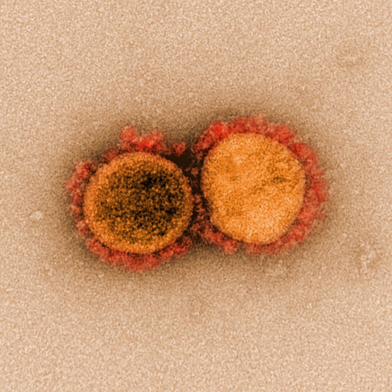 Vacina universal pode ajudar a prevenir futuros surtos de novos coronavírus - (Foto: National Reprodução/Institute of Allergy and Infectious Diseases)